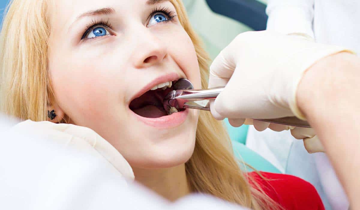 هل خلع الضرس يؤثر على باقي الأسنان